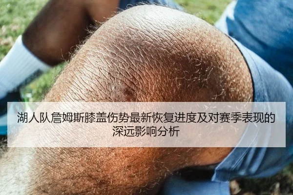 湖人队詹姆斯膝盖伤势最新恢复进度及对赛季表现的深远影响分析